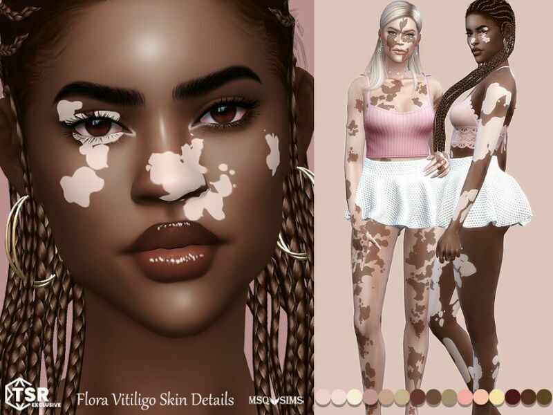 Flora Vitiligo Skin Details By Msqsims 1 Flora Vitiligo Skin Details By Msqsims Sims 4 CC
