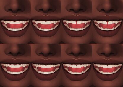 Unique Yaeba Teeth for All Ages 3 sims 4 cc teeths yaeba 01 by wightspider07 5