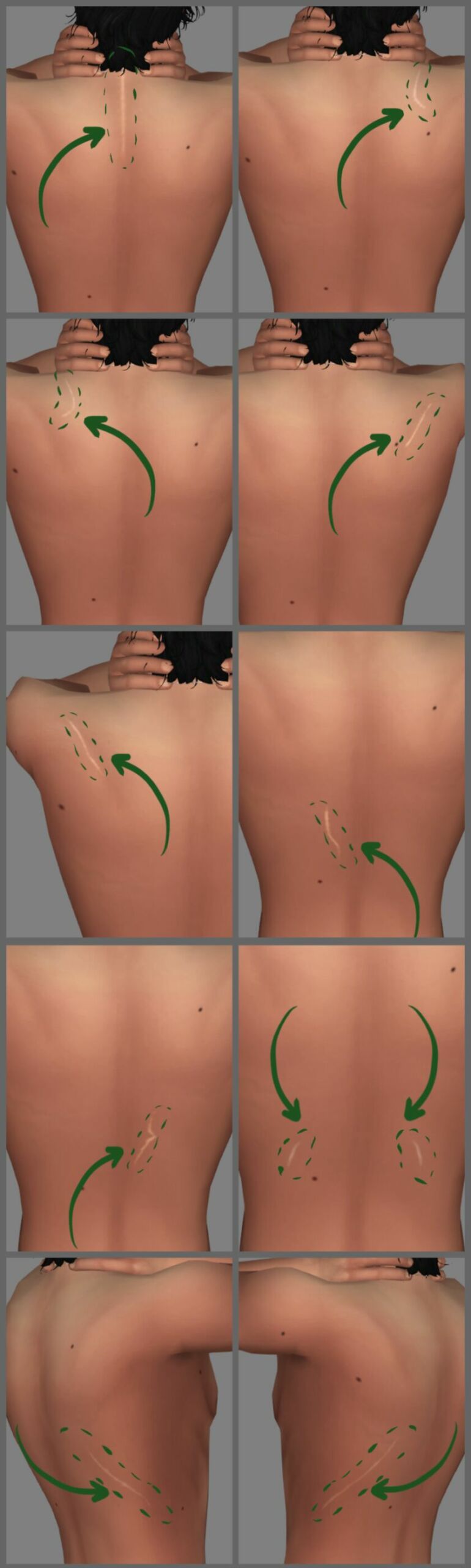 Introducing Scars 'Carnation' Version 1 2 sims 4 cc scars carnation version 1 2 scaled