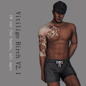 Vitiligo “Birch” Version 2.1 Sims 4 CC