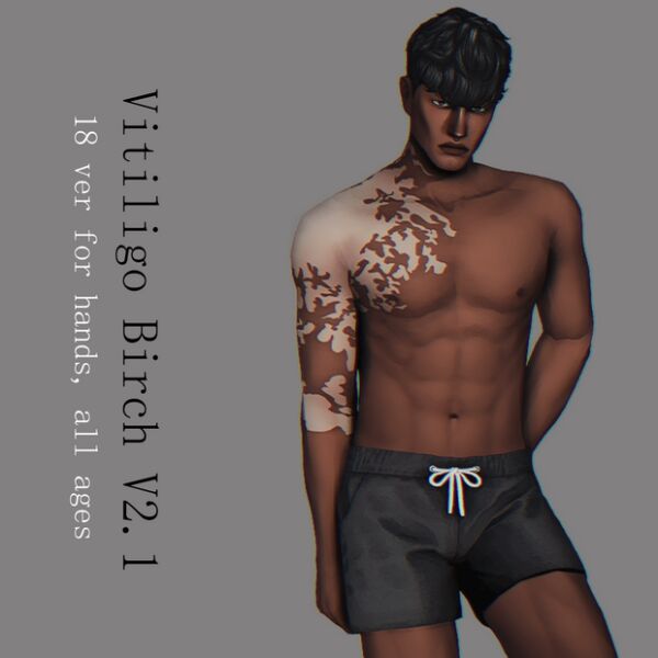 Vitiligo “Birch” Version 2.1 Sims 4 CC