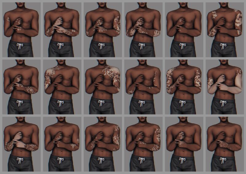 sims 4 cc vitiligo birch version 2 1 by jarride 2
